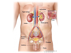 前列腺和肾癌的局部治疗
